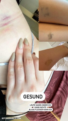 Kdrkitten Nude Twitch – Leaked Nude Photo